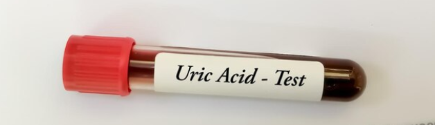 Asam Urat Darah