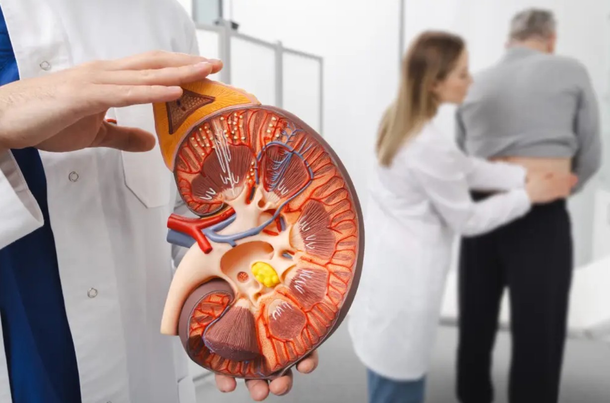 Sindrom Uremik Hemolitik