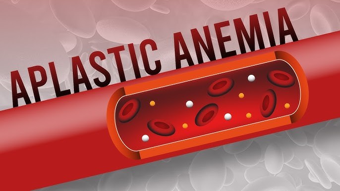 Anemia Aplastik