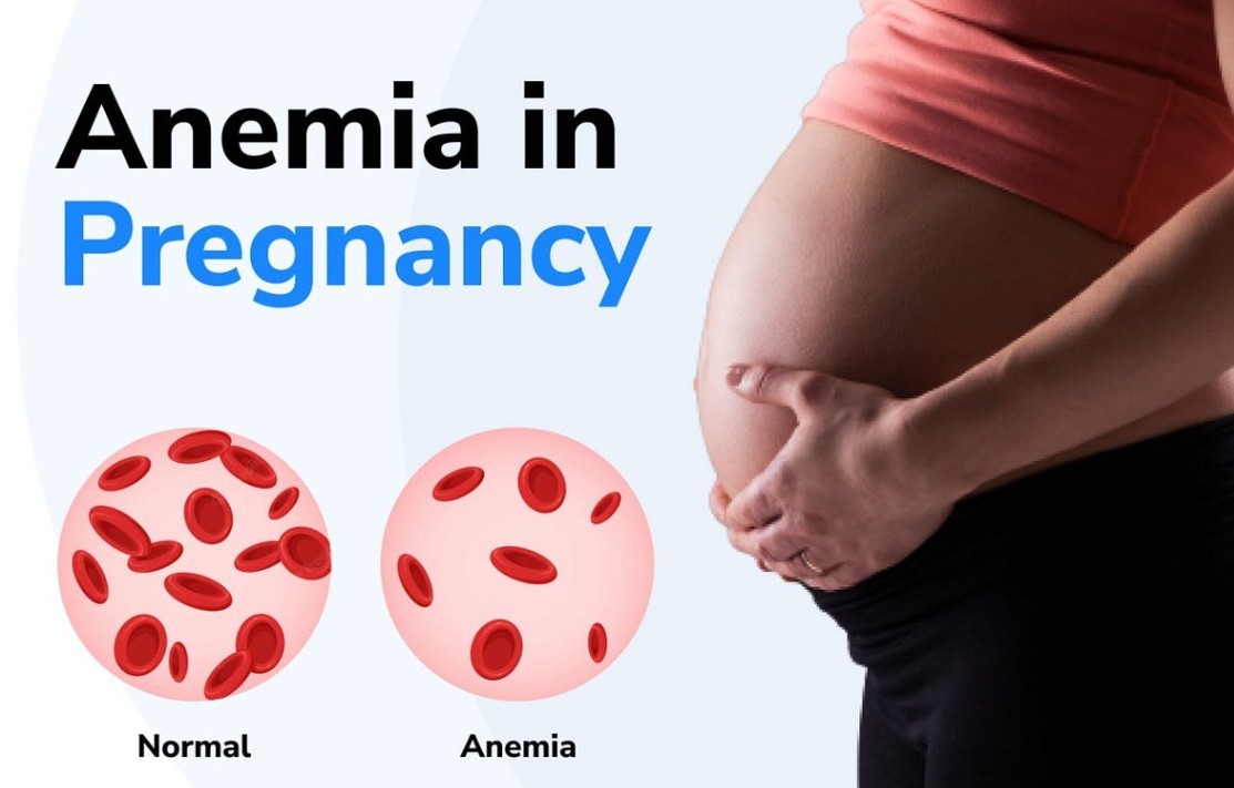Anemia pada Kehamilan
