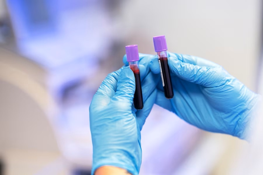 Manfaat Tes NIPT saat Sedang Hamil