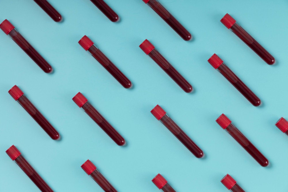 Gejala dan Penyebab Bakteremia, Ketika Bakteri Masuk ke Aliran Darah