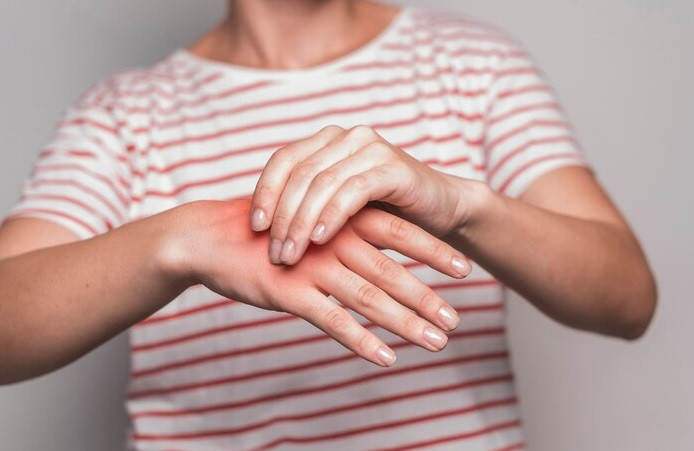 Pertolongan yang Tepat saat Terkena Air Panas